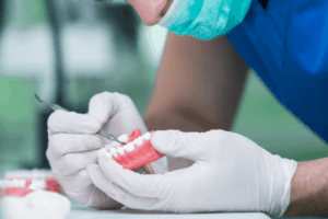 Tworzenie protez zębowych, jakie są między nimi różnice?